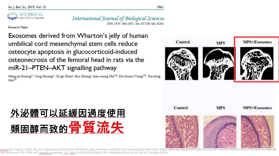 iPSC外泌體在骨質保護的研究