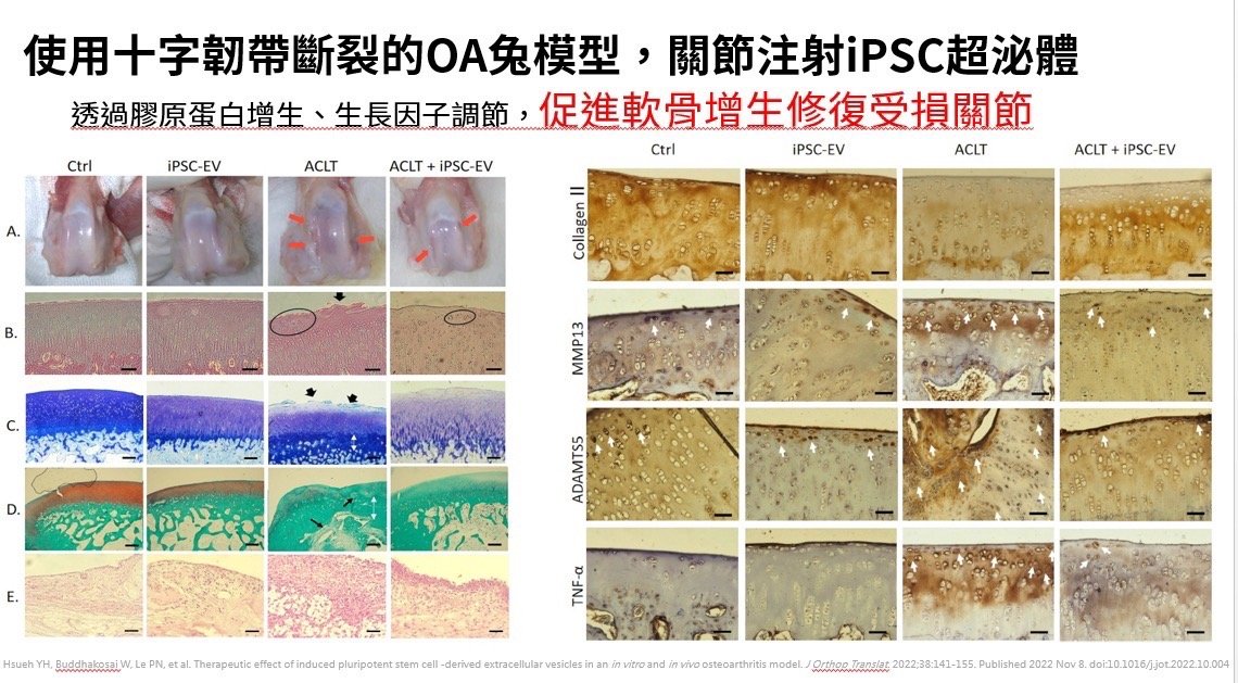 iPSC外泌體在關節軟骨修復的研究
