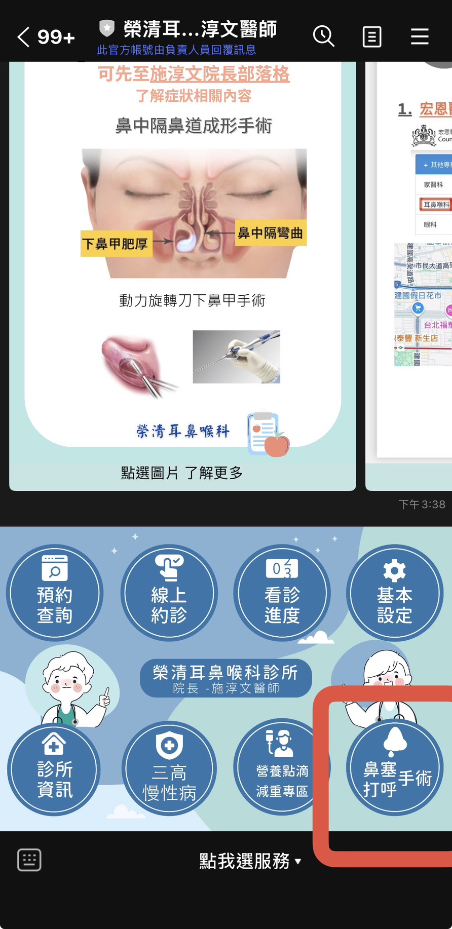 加入LINE@後選擇鼻塞打呼手術