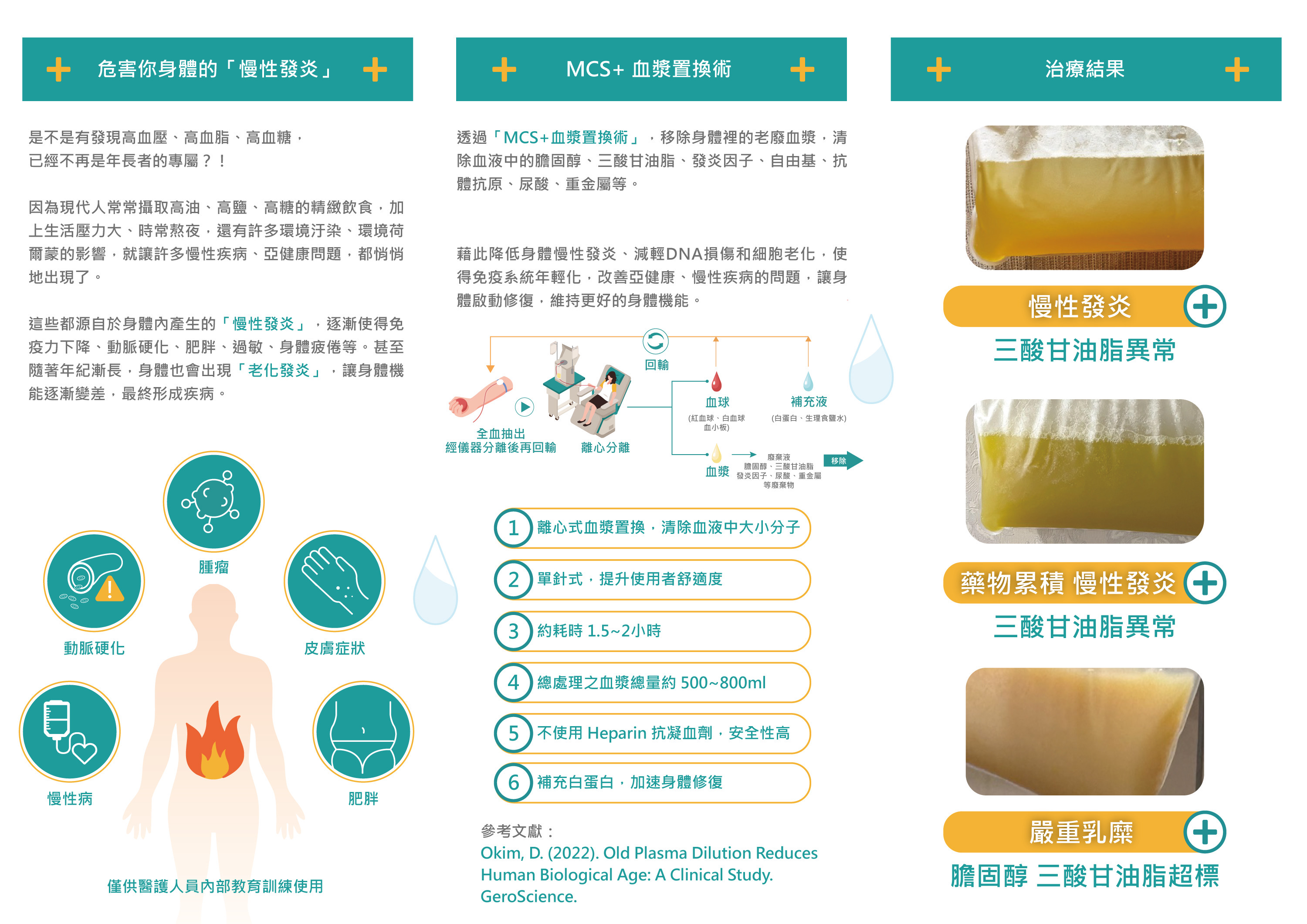 血液淨化MCS+療程完整介紹 — 原理、流程與治療效果