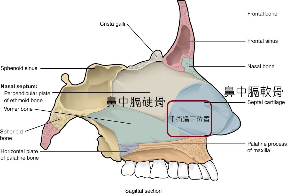 鼻中隔手術解剖位置示意圖